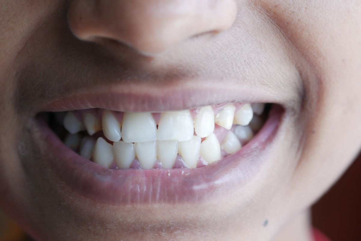 Gros plan sur un sourire aux gencives saines