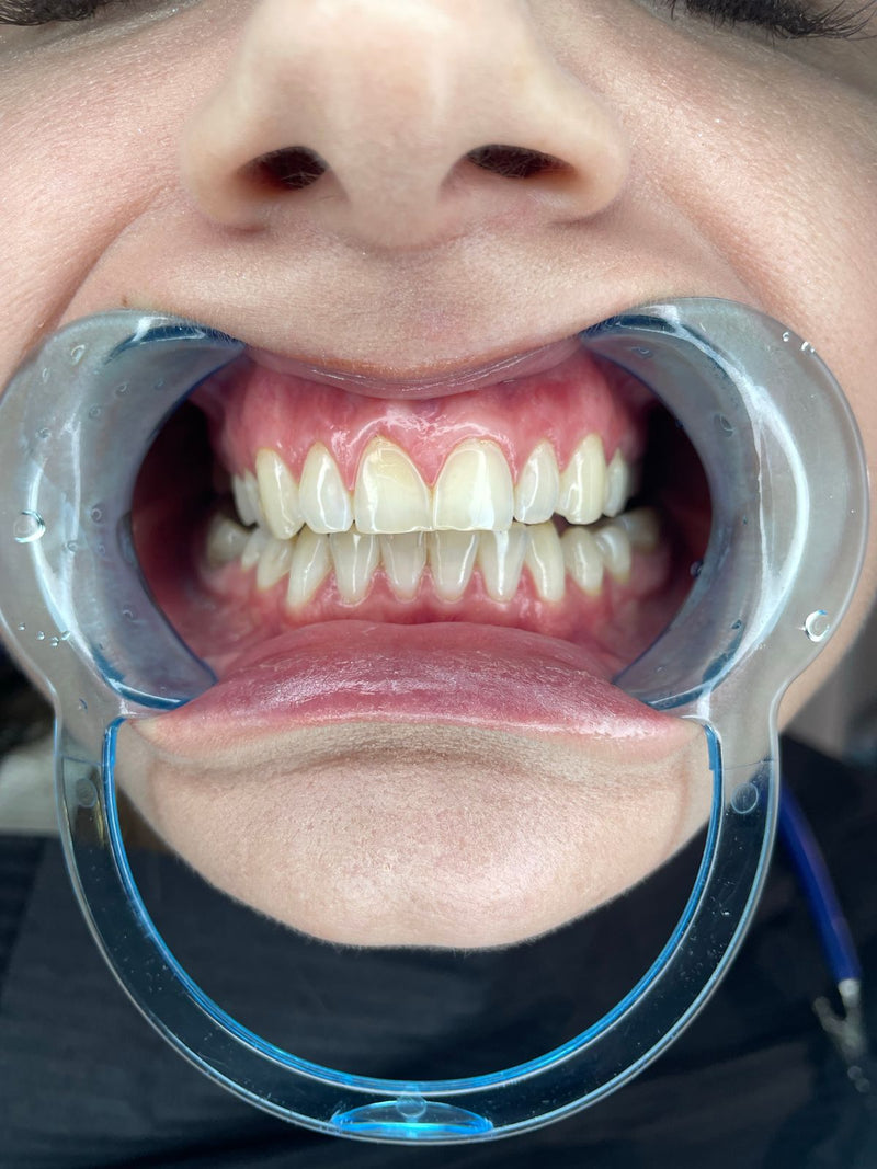 Contrôle des dents et du bord des gencives chez le dentiste