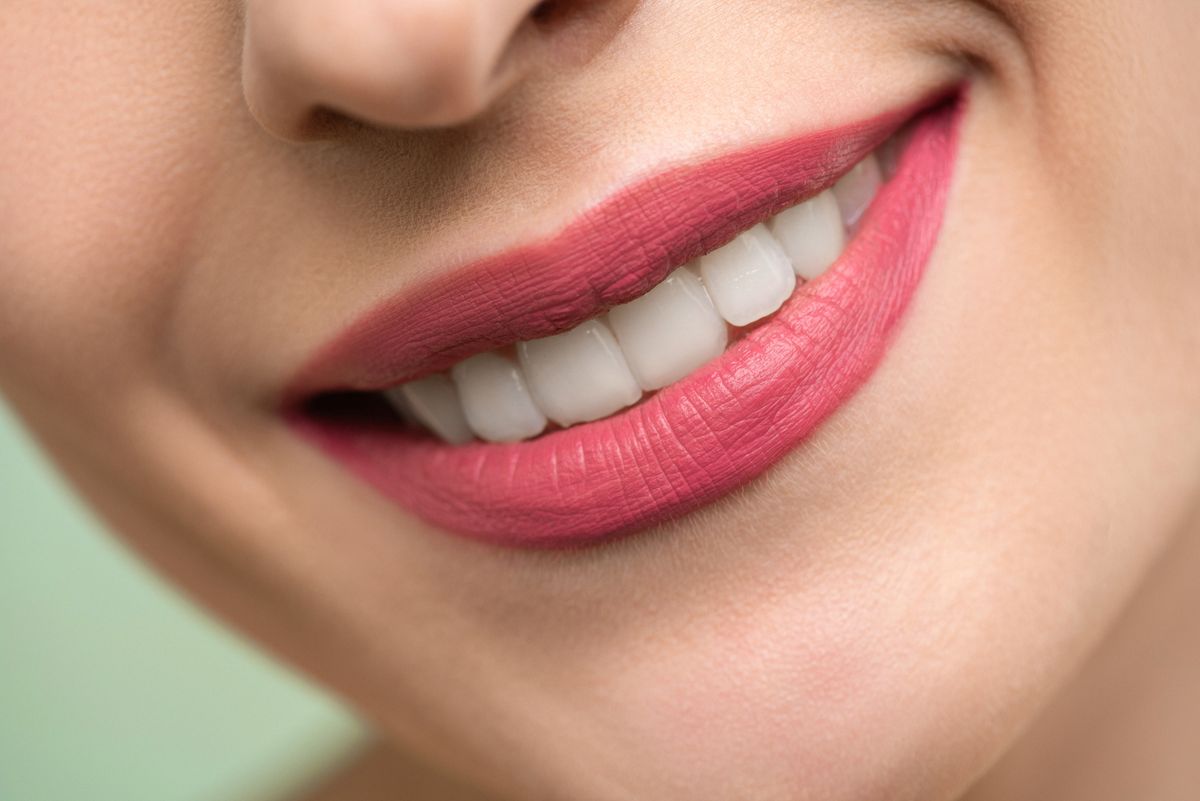 Femme souriante aux dents blanches après usage d'un dentifrice blanchissant