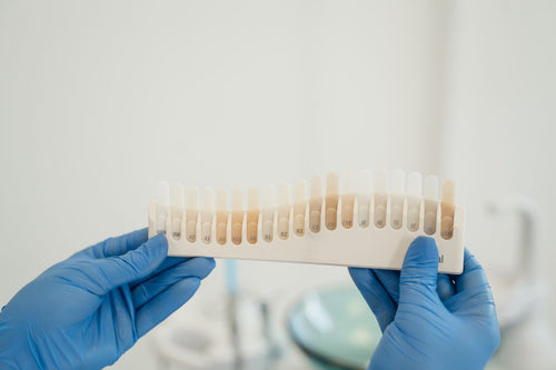 Teeth whitening kits: the honest guide to the 5 types (what works, what damages, what is illegal)