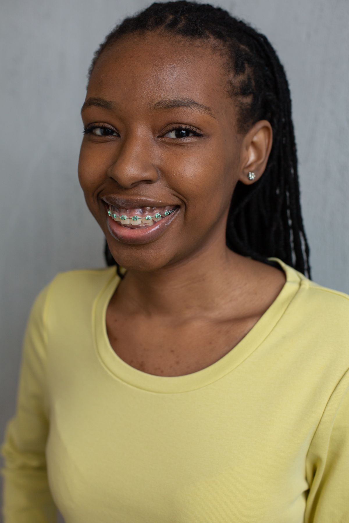 Braces and aligners: keeping teeth healthy during orthodontic treatment