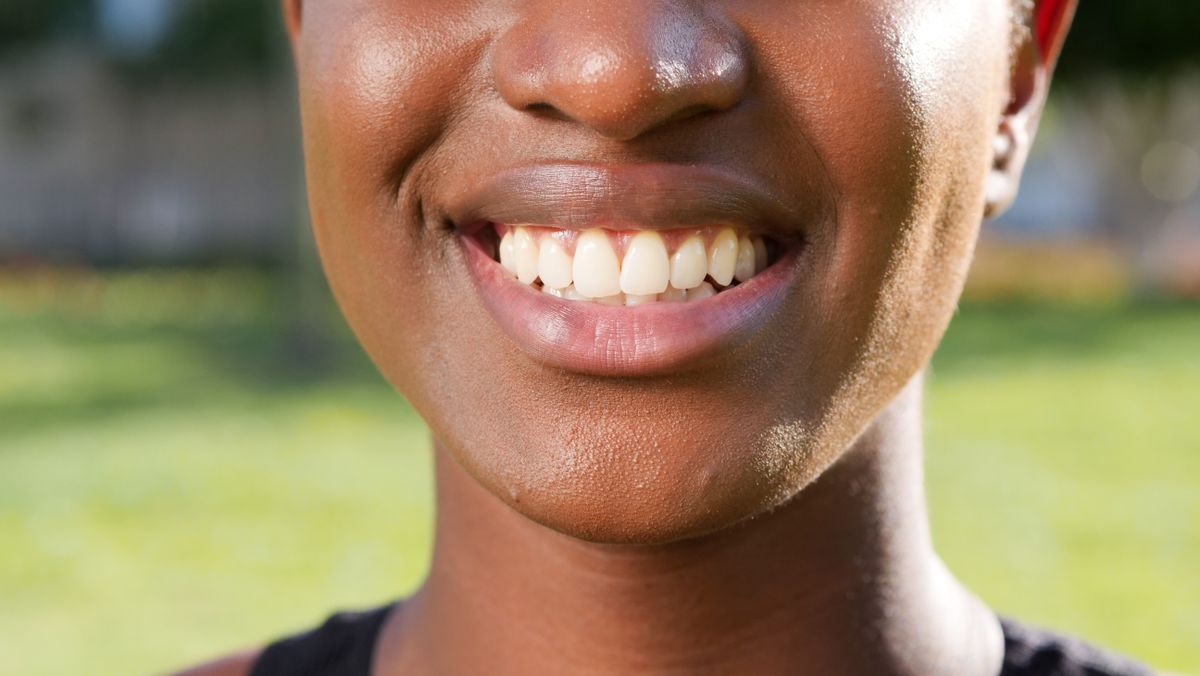 Dientes translúcidos: por qué los bordes se ven transparentes y qué hacer