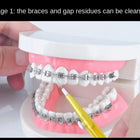Brossette jaune passée entre les bagues d’un modèle de dentition avec appareil